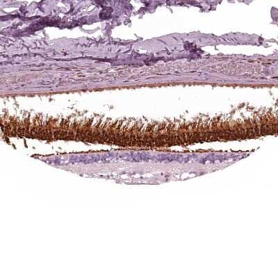 Immunohistochemistry-Paraffin: AIPL1 Antibody [NBP2-55506] - Staining of human retina shows strong cytoplasmic and nuclear positivity in photoreceptor cells.