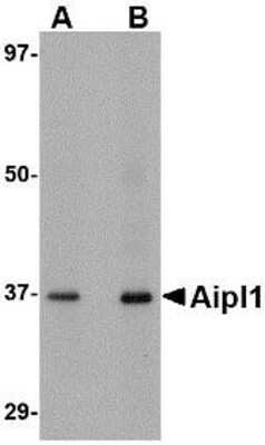 Western Blot: AIPL1 Antibody [NBP1-76953] - Human brain tissue lysate with Aipl1 antibody at (A) 1 and (B) 2 ug/ml.