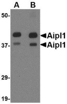 Western Blot: AIPL1 Antibody [NBP1-76956] - Rat brain tissue lysate with Aipl1 antibody at (A) 1 and (B) 2 ug/ml.