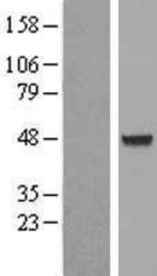 Western Blot: AIPL1 Overexpression Lysate (Adult Normal) [NBL1-07416] Left-Empty vector transfected control cell lysate (HEK293 cell lysate); Right -Over-expression Lysate for AIPL1.