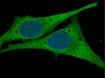 Immunocytochemistry/Immunofluorescence: AK2 Antibody (009) [NBP2-90182] - Immunofluorescence staining of AK2 in Hela cells. Cells were fixed with 4% PFA, permeabilzed with 0.3% Triton X-100 in PBS, blocked with 10% serum, and incubated with rabbit anti-human AK2 monoclonal antibody (1:60) at 4? overnight. Then cells were stained with the Alexa Fluor(R) 488-conjugated Goat Anti-rabbit IgG secondary antibody (green) and counterstained with DAPI (blue).