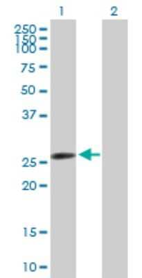 Western Blot: AK2 Antibody [H00000204-B01P] - Analysis of AK2 expression in transfected 293T cell line by AK2 polyclonal antibody.  Lane1:AK2 transfected lysate(26.29 KDa). Lane2:Non-transfected lysate.