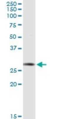 Western Blot: AK2 Antibody [H00000204-D01P] - Analysis of AK2 expression in human kidney.