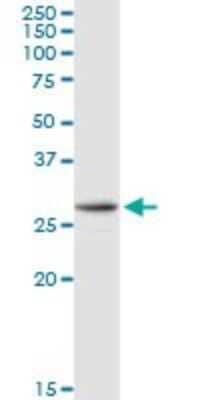 Western Blot: AK2 Antibody [H00000204-D01P] - Analysis of AK2 expression in mouse kidney.