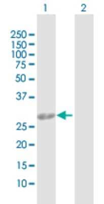 Western Blot: AK2 Antibody [H00000204-D01P] - Analysis of AK2 expression in transfected 293T cell line by AK2 polyclonal antibody.Lane 1: AK2 transfected lysate(26.50 KDa).Lane 2: Non-transfected lysate.