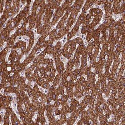Immunohistochemistry-Paraffin: AK3 Antibody [NBP2-49393] - Staining of human liver shows cytoplasmic positivity in hepatocytes.