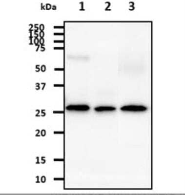 Western Blot: AK3 Antibody (SJB3-36) [NBP1-04261] - The lysate (40ug) were resolved by SDS-PAGE, transferred to NC membrane and probed with anti-human AK3 antibody (1:1000). Proteins were visualized using a goat anti-mouse secondary antibody conjugated to HRP and an ECL detection system. Lane 1. : Hep3B cell lysate Lane 2. : 293T cell lysate Lane 3. : Mouse kidney tissue lysate