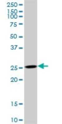 Western Blot: AK3 Antibody [H00050808-B01P] - Analysis of AK3 expression in HepG2.