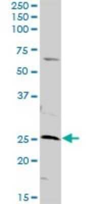 Western Blot: AK3 Antibody [H00050808-D01P] - Analysis of AK3 expression in HeLa.