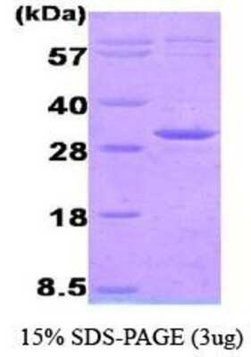 SDS-PAGE Recombinant Human AK3 His Protein