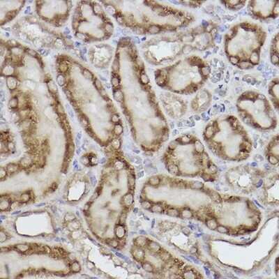 Immunohistochemistry-Paraffin: AK3L1 Antibody (9T5P1) [NBP3-16116] - Immunohistochemistry of paraffin-embedded rat kidney using AK3L1 Rabbit mAb (NBP3-16116) at dilution of 1:100 (40x lens).Perform high pressure antigen retrieval with 10 mM citrate buffer pH 6.0 before commencing with IHC staining protocol.