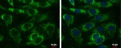 Immunocytochemistry/Immunofluorescence: AK3L1 Antibody [NBP2-15317] - AK3L1 antibody detects Adenylate kinase 4 protein at mitochondria by immunofluorescent analysis. Sample: SKNSH cells were fixed in 2% paraformaldehyde/culture medium at 37C for 30 min. Green: AK3L1 protein stained by AK3L1 antibody diluted at 1:500. Blue: Hoechst 33342 staining. Scale bar = 10 um.