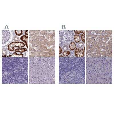 <b>Independent Antibodies Validation. </b>Immunohistochemistry-Paraffin: AK3L1 Antibody [NBP2-47553] - Staining of human kidney, liver, lymph node and pancreas using Anti-AK4 antibody NBP2-47553 (A) shows similar protein distribution across tissues to independent antibody NBP2-48773 (B).