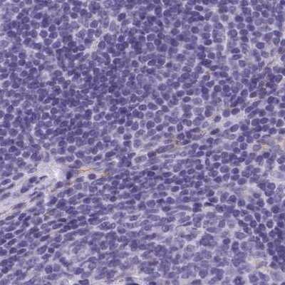 Immunohistochemistry-Paraffin: AK3L1 Antibody [NBP2-47553] - Staining of human lymph node.