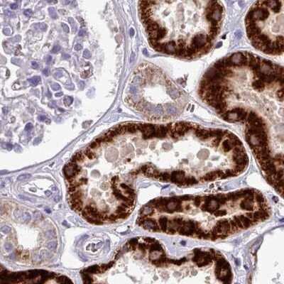 Immunohistochemistry-Paraffin: AK3L1 Antibody [NBP2-47553] - Staining of human kidney using Anti-AK4 antibody NBP2-47553.