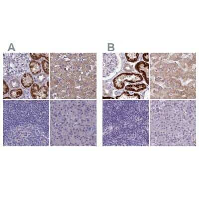 <b>Independent Antibodies Validation. </b>Immunohistochemistry-Paraffin: AK3L1 Antibody [NBP2-48773] - Staining of human kidney, liver, lymph node and pancreas using Anti-AK4 antibody NBP2-48773 (A) shows similar protein distribution across tissues to independent antibody NBP2-47553 (B).