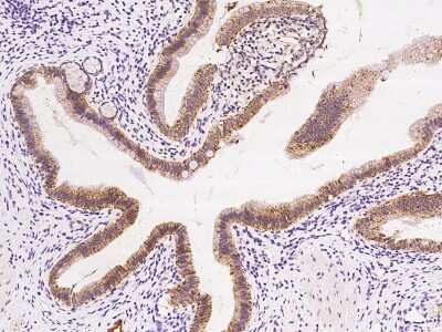 Immunohistochemistry-Paraffin: AK3L1 Antibody [NBP2-97592] - Staining of human AK3L1 in human gallbladder with rabbit polyclonal antibody at 1:100 dilution.