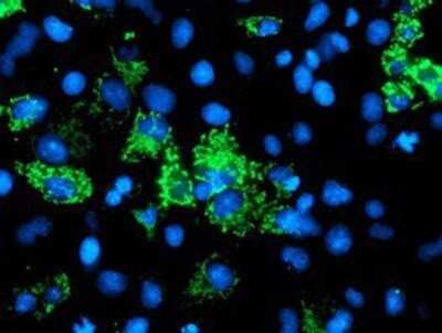 Immunocytochemistry/Immunofluorescence: AK3L1 Antibody (OTI3B1) - Azide and BSA Free [NBP2-70129] - Staining of COS7 cells transiently transfected by pCMV6-ENTRY AK3L1.