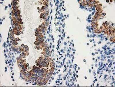 Immunohistochemistry: AK3L1 Antibody (OTI3B1) - Azide and BSA Free [NBP2-70129] - Staining of paraffin-embedded Human endometrium tissue using anti-AK3L1 mouse monoclonal antibody.