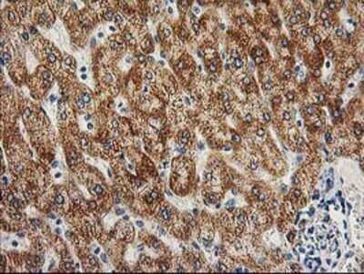 Immunohistochemistry: AK3L1 Antibody (OTI3B1) - Azide and BSA Free [NBP2-70129] - Staining of paraffin-embedded Human liver tissue using anti-AK3L1 mouse monoclonal antibody.
