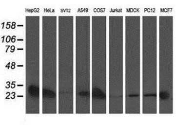 Western Blot: AK3L1 Antibody (OTI3B1) - Azide and BSA Free [NBP2-70129] - Analysis of extracts (35ug) from 9 different cell lines by using anti-AK3L1 monoclonal antibody.