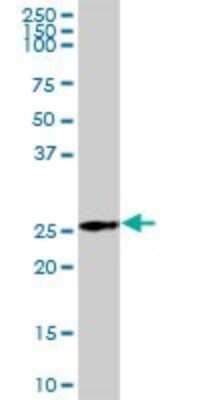 Western Blot: AK3L1 Antibody [H00000205-B02P] - Analysis of AK3L1 expression in human liver.