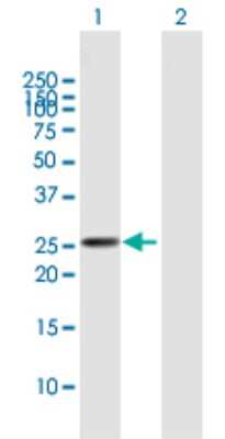Western Blot: AK3L1 Antibody [H00000205-B02P] - Analysis of AK3L1 expression in transfected 293T cell line by AK3L1 polyclonal antibody.  Lane 1: AK3L1 transfected lysate(24.53 KDa). Lane 2: Non-transfected lysate.