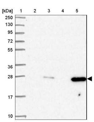 Western Blot: AK3L1 Antibody [NBP2-47553] - Lane 1: Marker  [kDa] 250, 130, 95, 72, 55, 36, 28, 17, 10.  Lane 2: Human cell line RT-4.  Lane 3: Human cell line U-251MG.  Lane 4: Human plasma (IgG/HSA depleted).  Lane 5: Human liver tissue.