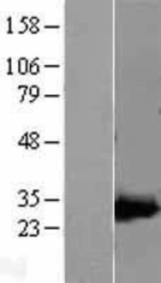 Western Blot: AK3L1 Overexpression Lysate (Adult Normal) [NBL1-07420] Left-Empty vector transfected control cell lysate (HEK293 cell lysate); Right -Over-expression Lysate for AK3L1.