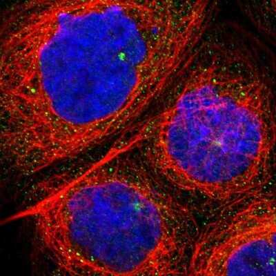 Immunocytochemistry/Immunofluorescence: AK5 Antibody [NBP1-89453] - Immunofluorescent staining of human cell line A-431 shows localization to cytosol & microtubule organizing center.
