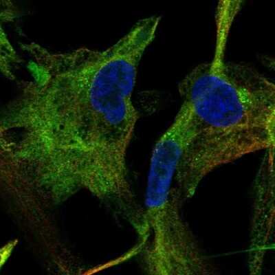 Immunocytochemistry/Immunofluorescence: AK5 Antibody [NBP1-89453] - Staining of human cell line LHCN-M2 shows localization to cytosol. Antibody staining is shown in green.