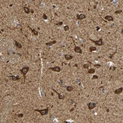 Immunohistochemistry-Paraffin: AK5 Antibody [NBP1-89453] - Staining of human hippocampus shows strong cytoplasmic and nucleolar positivity in neuronal cells.