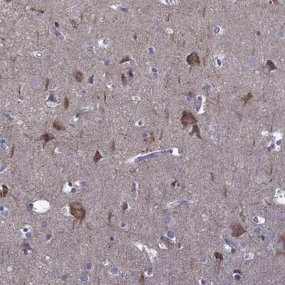 Immunohistochemistry-Paraffin: AK5 Antibody [NBP1-89453] - Staining of human cerebral cortex shows high expression.
