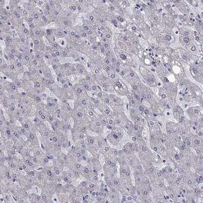 Immunohistochemistry-Paraffin: AK5 Antibody [NBP1-89453] - Staining of human liver shows low expression as expected.
