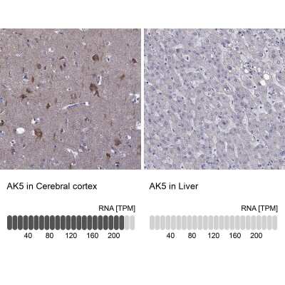 <b>Orthogonal Strategies Validation. </b>Immunohistochemistry-Paraffin: AK5 Antibody [NBP1-89453] - Staining in human cerebral cortex and liver tissues using anti-AK5 antibody. Corresponding AK5 RNA-seq data are presented for the same tissues.