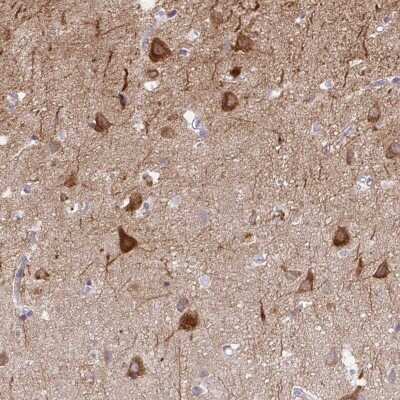 Immunohistochemistry-Paraffin: AK5 Antibody [NBP2-33821] - Staining of human cerebral cortex shows high expression.
