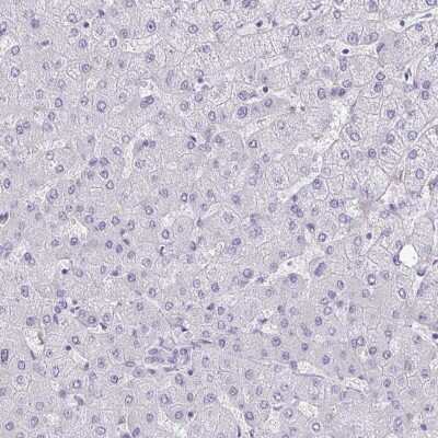 Immunohistochemistry-Paraffin: AK5 Antibody [NBP2-33821] - Staining of human liver shows low expression as expected.