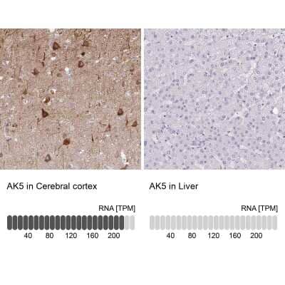 <b>Orthogonal Strategies Validation. </b>Immunohistochemistry-Paraffin: AK5 Antibody [NBP2-33821] - Staining in human cerebral cortex and liver tissues using anti-AK5 antibody. Corresponding AK5 RNA-seq data are presented for the same tissues.