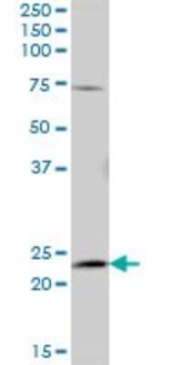 Western Blot: AK5 Antibody [H00026289-B01P] - Analysis of AK5 expression in rat brain.
