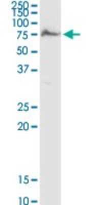 Western Blot: AK5 Antibody [H00026289-D01P] - Analysis of AK5 expression in IMR-32.