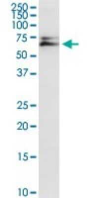 Western Blot: AK5 Antibody [H00026289-D01P] - Analysis of AK5 expression in rat brain.