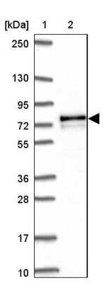 Western Blot AK5 Antibody - BSA Free