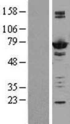 Western Blot: AK5 Overexpression Lysate (Adult Normal) [NBL1-07422] Left-Empty vector transfected control cell lysate (HEK293 cell lysate); Right -Over-expression Lysate for AK5.