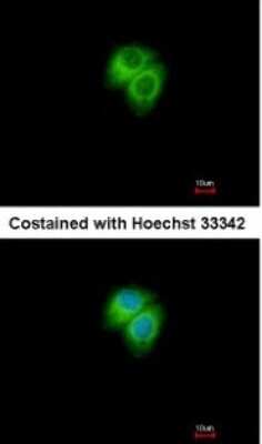 Immunocytochemistry/Immunofluorescence: AK7 Antibody [NBP1-32560] - Analysis of methanol-fixed Hep G2, using antibody at 1:500 dilution.