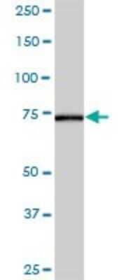 Western Blot: AK7 Antibody [H00122481-B01P] - Analysis of AK7 expression in human colon.