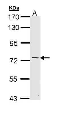 Western Blot: AK7 Antibody [NBP2-15318] - Sample (30 ug of whole cell lysate) A: Hela 7.5% SDS PAGE; antibody diluted at 1:1000.