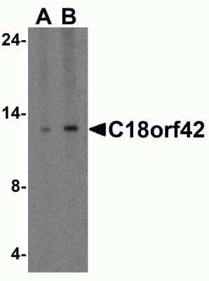 Western Blot: AKAIN1 Antibody [NBP2-81698] - Western blot analysis of AKAIN1 in HeLa cell lysate with AKAIN1 antibody at 1 ug/ml