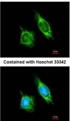 Immunocytochemistry/Immunofluorescence: AKAP1 Antibody [NBP2-15319] - Analysis of methanol-fixed HeLa, using antibody at 1:200 dilution.