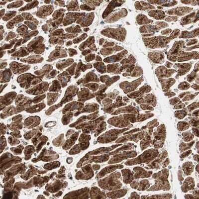 Immunohistochemistry-Paraffin: AKAP1 Antibody [NBP1-89172] - Staining of human heart muscle shows strong cytoplasmic positivity in myocytes.