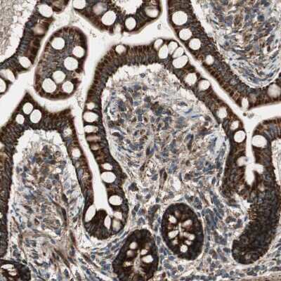 Immunohistochemistry-Paraffin: AKAP1 Antibody [NBP1-89172] - Staining of human small intestine shows strong cytoplasmic positivity in glandular cells.